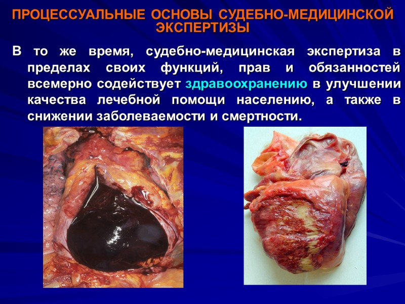 ПРОЦЕССУАЛЬНЫЕ ОСНОВЫ СУДЕБНО-МЕДИЦИНСКОЙ ЭКСПЕРТИЗЫ В то же время, судебно-медицинская экспертиза в пределах своих функций,